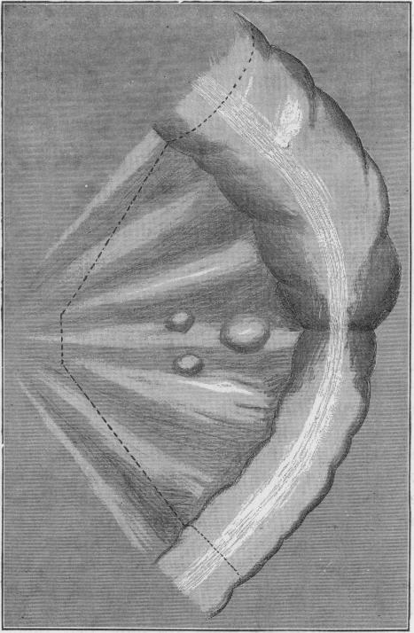 Fig. 32