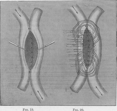 Figs. 19-20