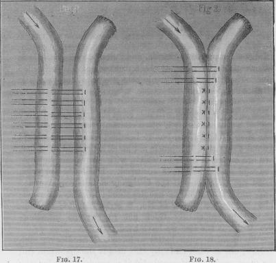 Figs. 17-18