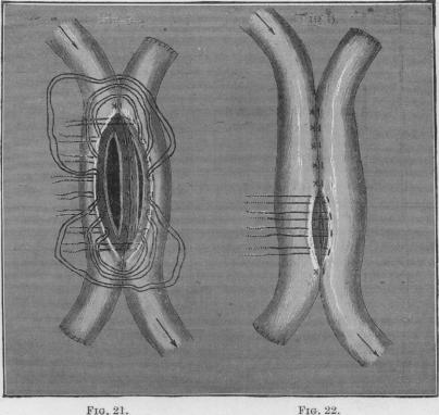 Figs. 21-22