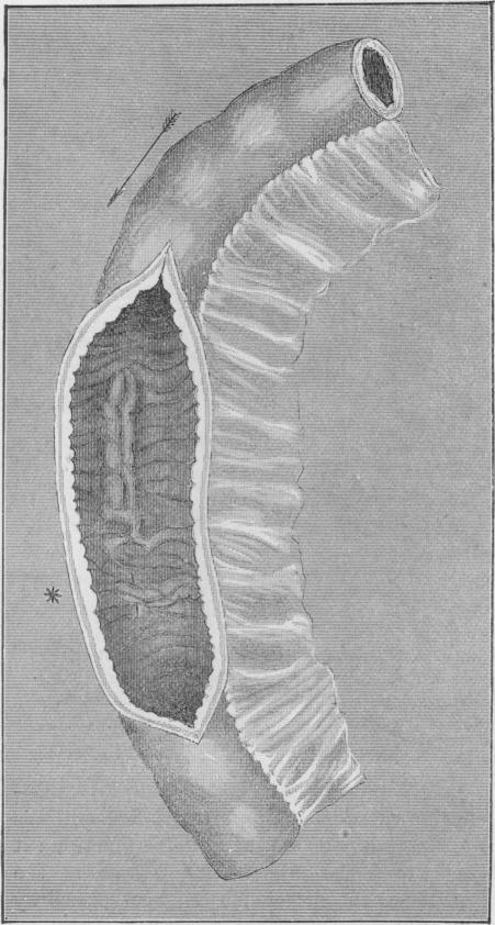 Fig. 13