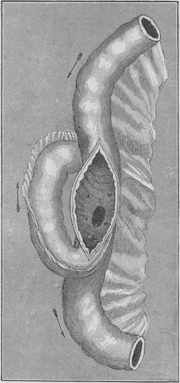 Fig. 43