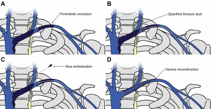 Fig 1