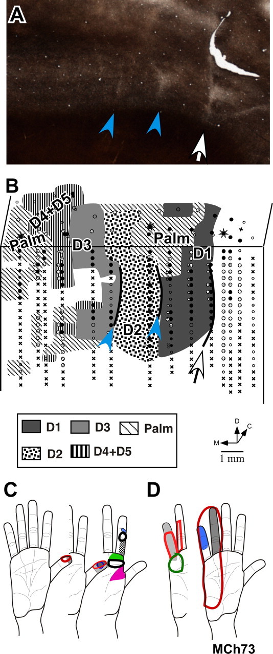 Figure 11.