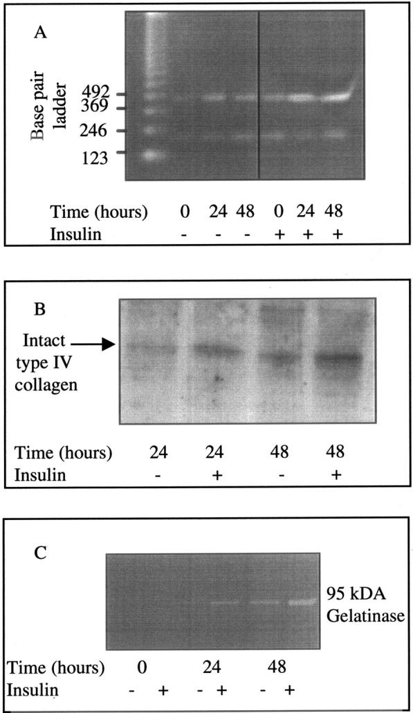 Figure 11.