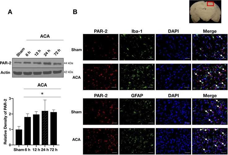 Fig. 2: