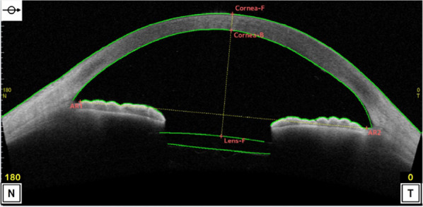Fig. 2