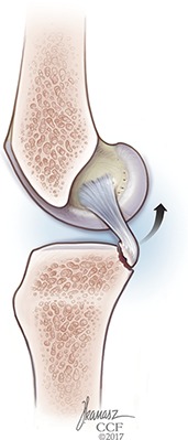 Fig. 1-B