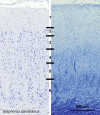 Fig. 11
