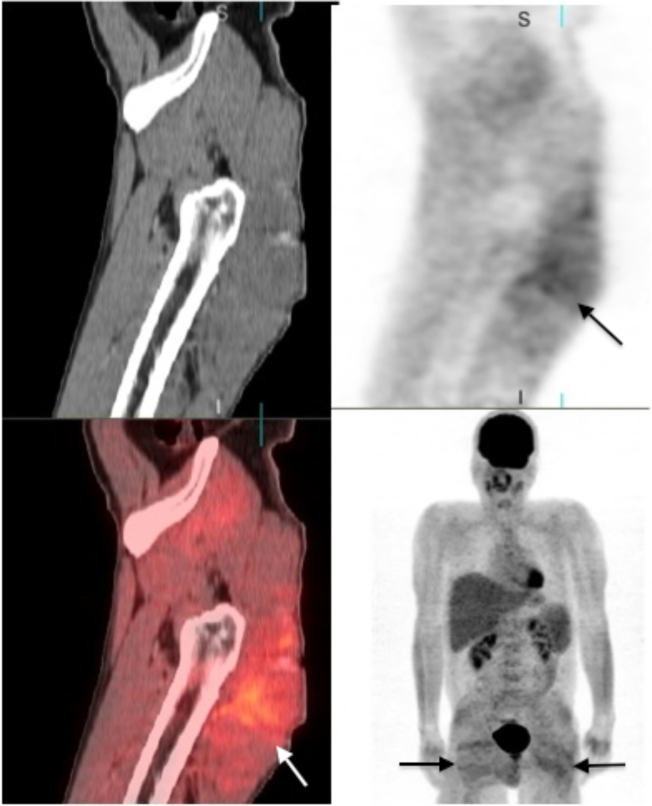 Figure 1C