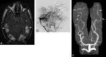 Fig 2.