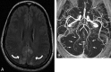Fig 5.