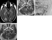 Fig 3.