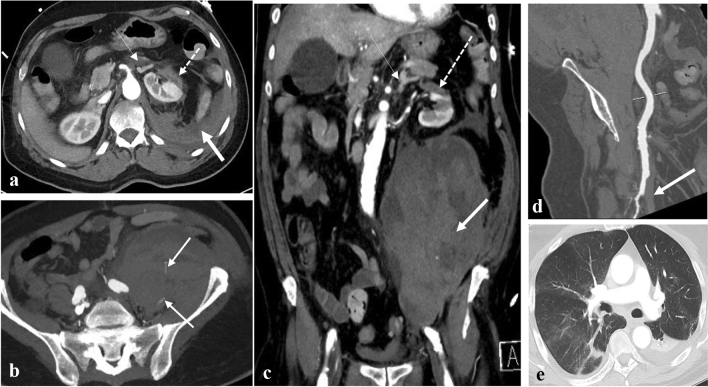 Fig. 1