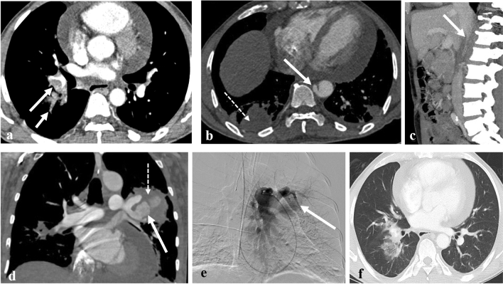 Fig. 6