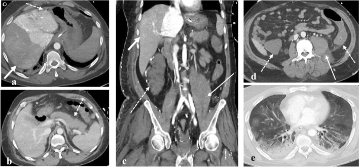 Fig. 4