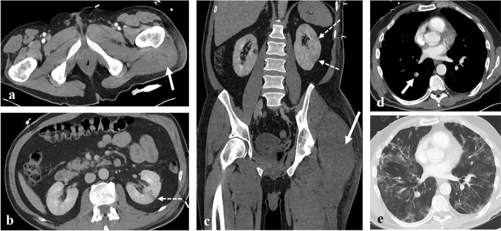 Fig. 3