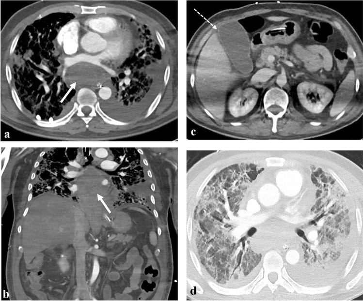 Fig. 2