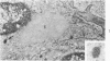 251