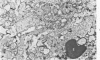 251