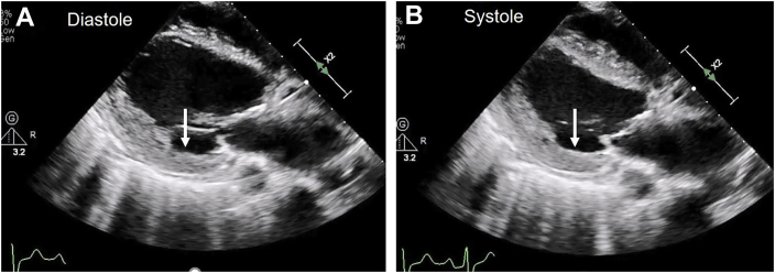 Figure 9