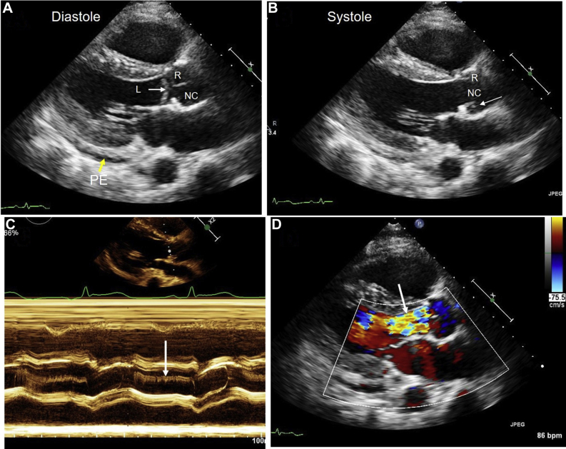 Figure 3