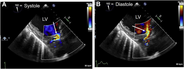 Figure 11