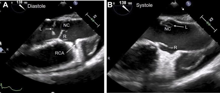 Figure 4