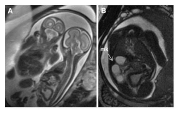 Figure 19