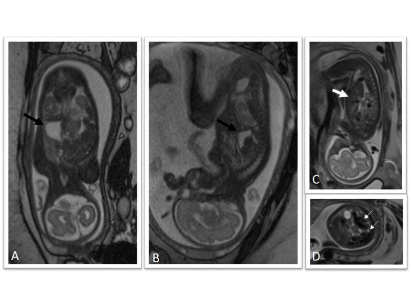 Figure 17