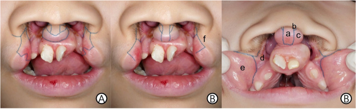 Fig. 3