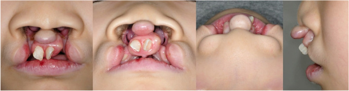 Fig. 1