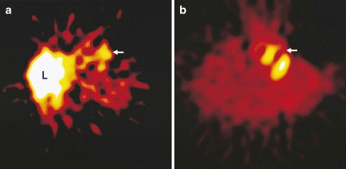 Fig. 3