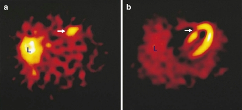 Fig. 2