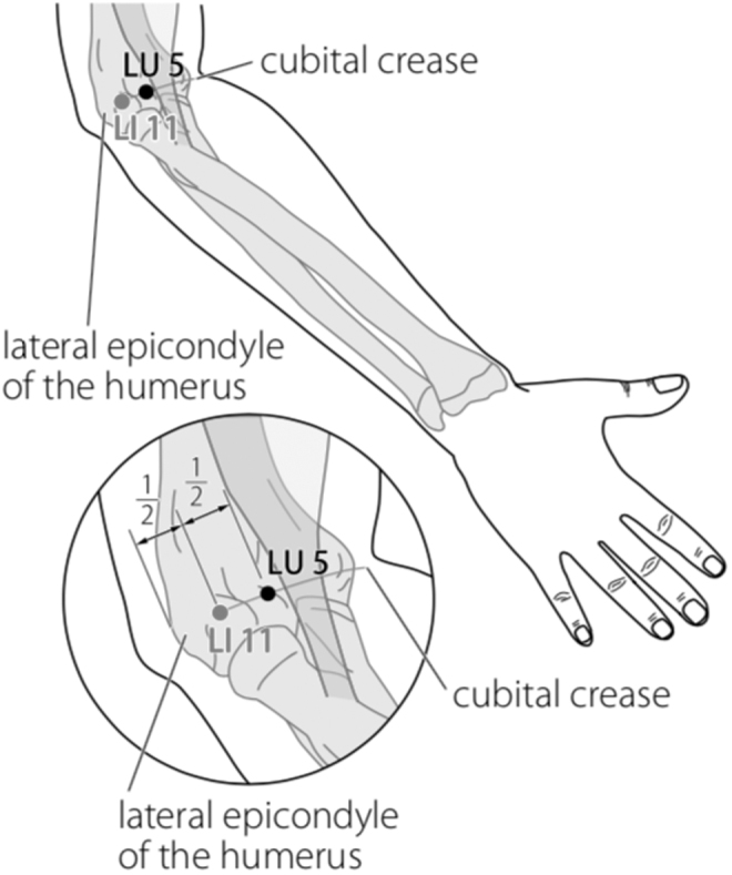 FIG. 3.