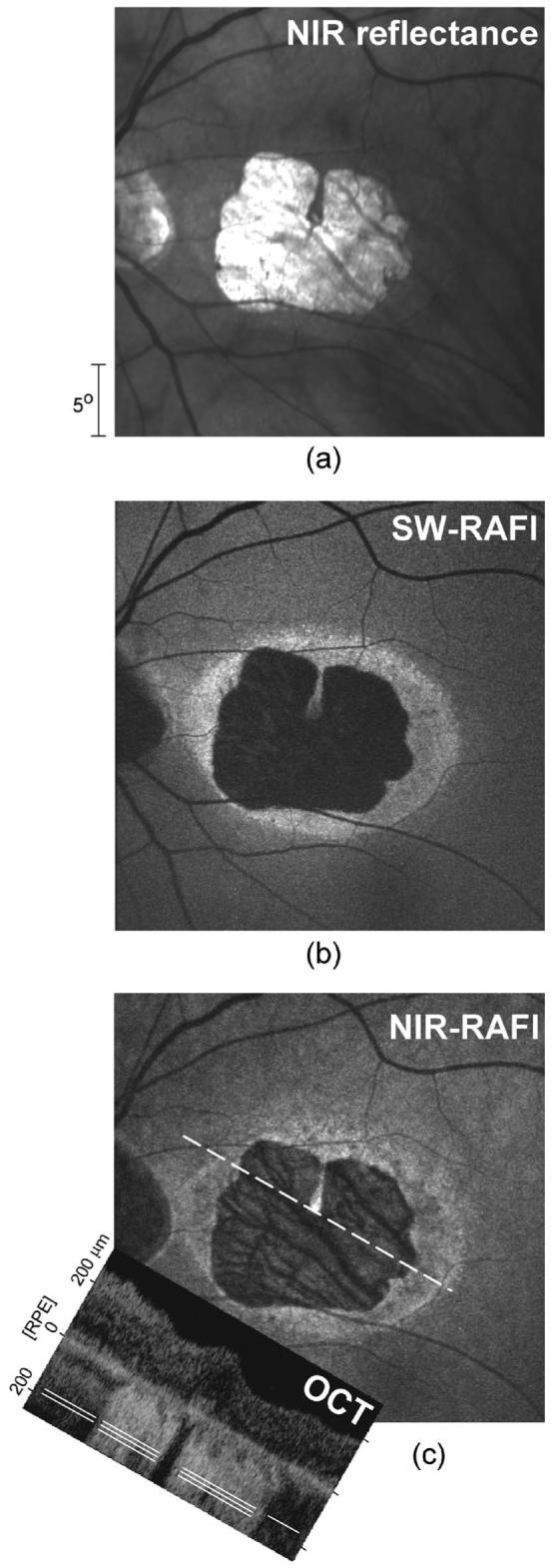 Fig. 2