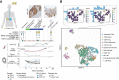 Figure 2. Intratumoral and intertumoral heterogeneity associated with resistance. A, Therapeutic timeline in a patient demonstrating pretreatment HER2 heterogeneity with a HER2+ primary tumor and HER2− but high PD-L1 CPS retroperitoneal lymph node (Supplementary Fig. S7). ERBB2 amplification was also identified in the primary tumor and ctDNA pretreatment. This patient initially responded to induction pembrolizumab and trastuzumab induction by ctDNA and radiographic measurements, but ctDNA was never cleared. Serial ctDNA identified a reappearance of ERBB2 amplification, as well as a new MET coamplification. Imaging identified new liver lesions that were later confirmed as metastases, as well as non-radiographically evident scalp lesions. Both the liver and scalp lesions were found to have strong MET expression by IHC upon progression. B, scRNA-seq analysis of 1,116 viable cells from an otherwise mostly necrotic on-treatment biopsy. Uniform manifold approximation and projection (UMAP) plots; color scale in inset indicates single tumor cell (n = 51) ERBB2 and FGFR3 RNA expression. Serial ctDNA assessment identified a pretreatment subclonal FGFR3-TACC3 fusion that expanded over time (see Supplementary Fig. S9).