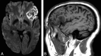 Fig 7.