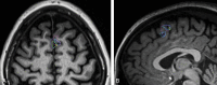 Fig 4.
