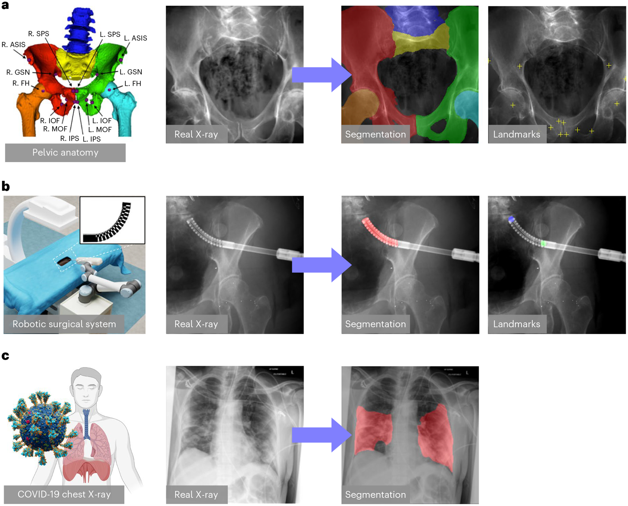 Fig. 2 |