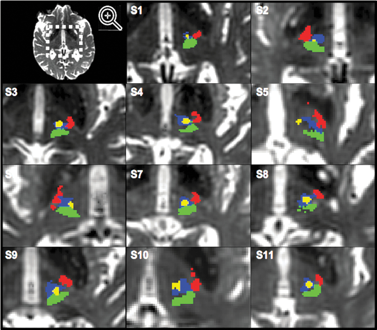 FIG. 2.