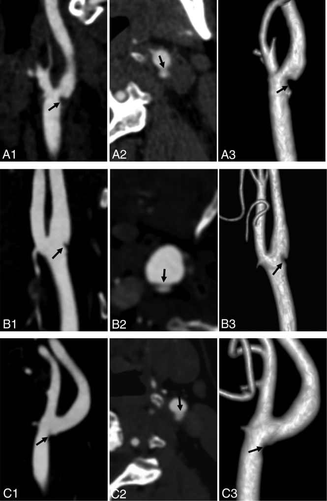 Fig 4.