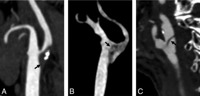 Fig 3.