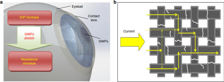 Figure 11