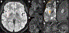 Fig 9.