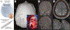 Fig 11.