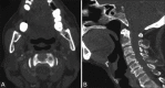 Figure 20 (A and B)
