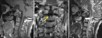 Figure 6 (A-C)
