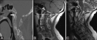 Figure 15 (A-C)