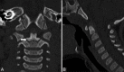 Figure 5 (A and B)